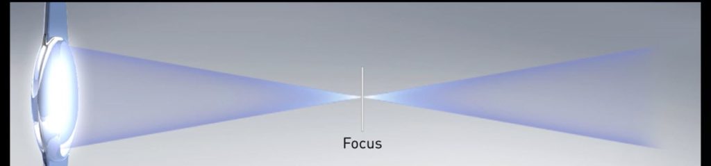 Accommodating Lens with Far Focus Explained.