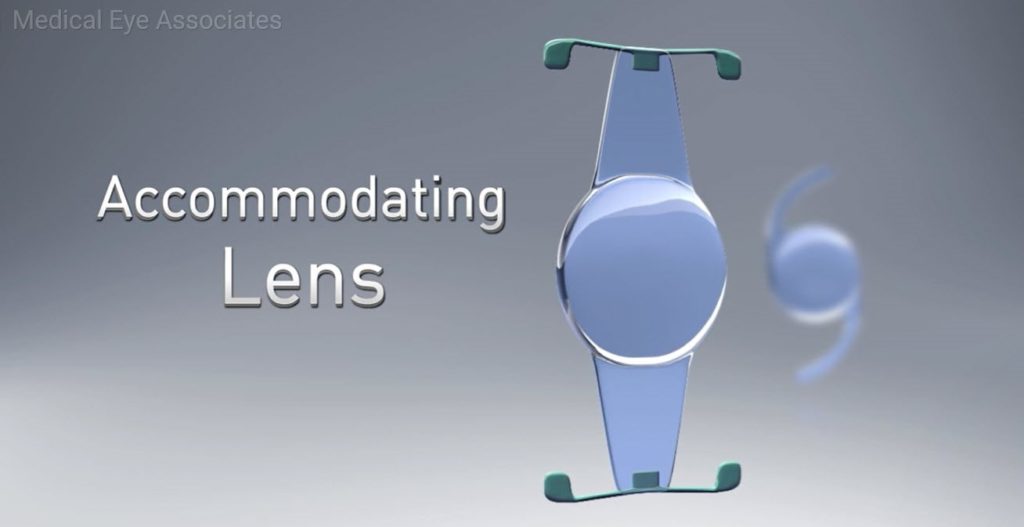 Accommodating Lens.