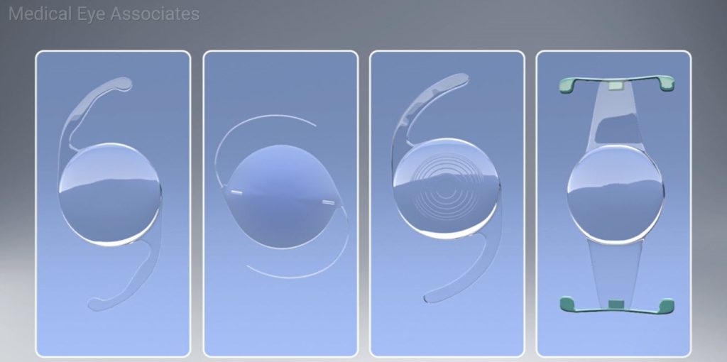 Lens choices for cataract surgery.