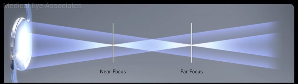 Multifocal Lens Explained.