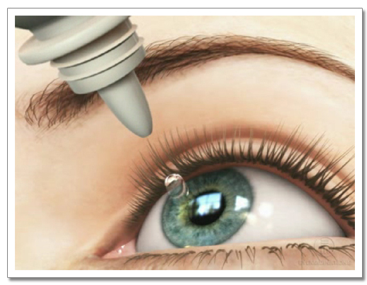 Applying dry eye drops to irritated eye – dry eye treatment at Medical Eye Associates